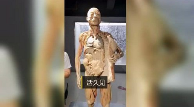 博物馆惊悚的一幕，1942年的人体标本，还是真人捐赠！